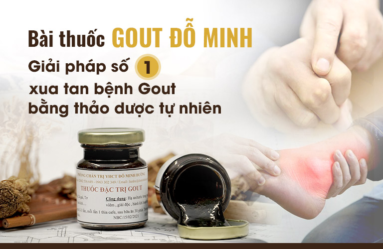 Bài thuốc Gout Đỗ Minh - Giải pháp số 1 cho bệnh nhân gout cấp và mạn tính