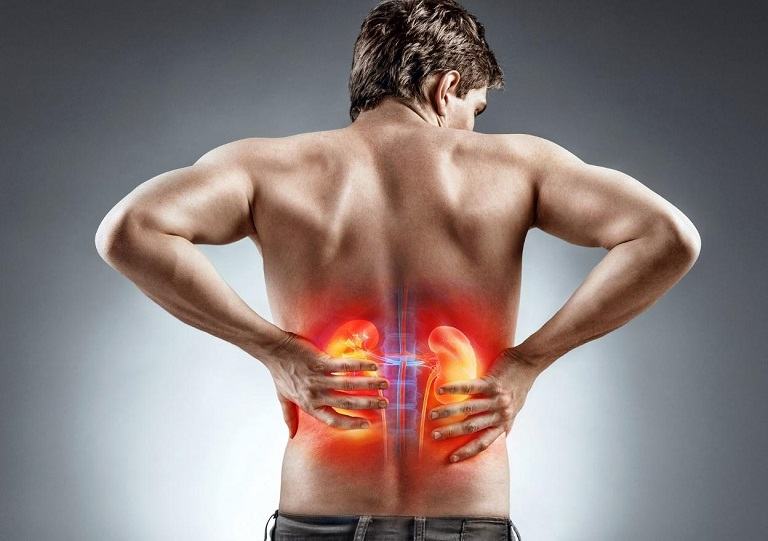 Người bệnh gout mãn tính có thể gặp vấn đề về thận Người bệnh gout mãn tính có thể gặp vấn đề về thận