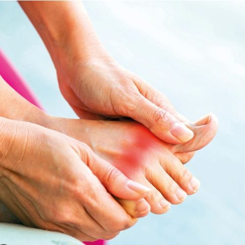 Gout bệnh lý phổ biến, có thể gặp phải ở bất cứ ai