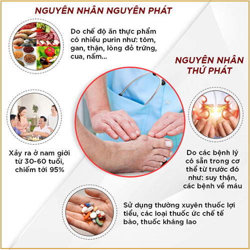 Nguyên nhân gây gout