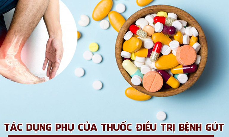 Cảnh giác trước tác dụng phụ của thuốc trị gout nếu lạm dụng